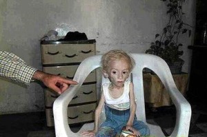 « Ligue humanitaire pour une Syrie libre » (Bassin minier)