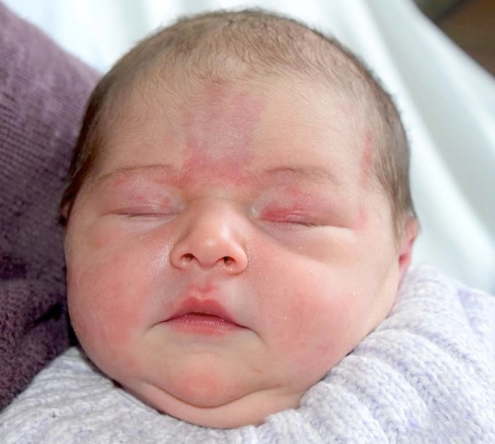 bebe mathilde 0705155