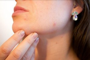 L’égalité d’accès aux soins en dermatologie