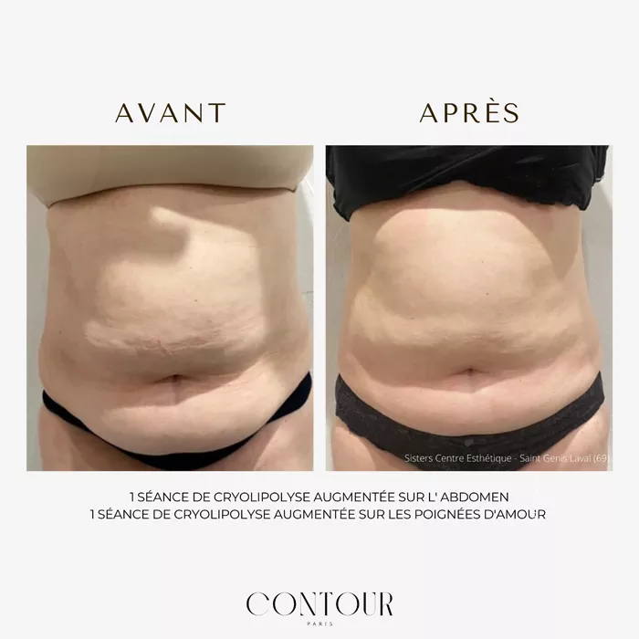 bel-oceane-minceur-1303266