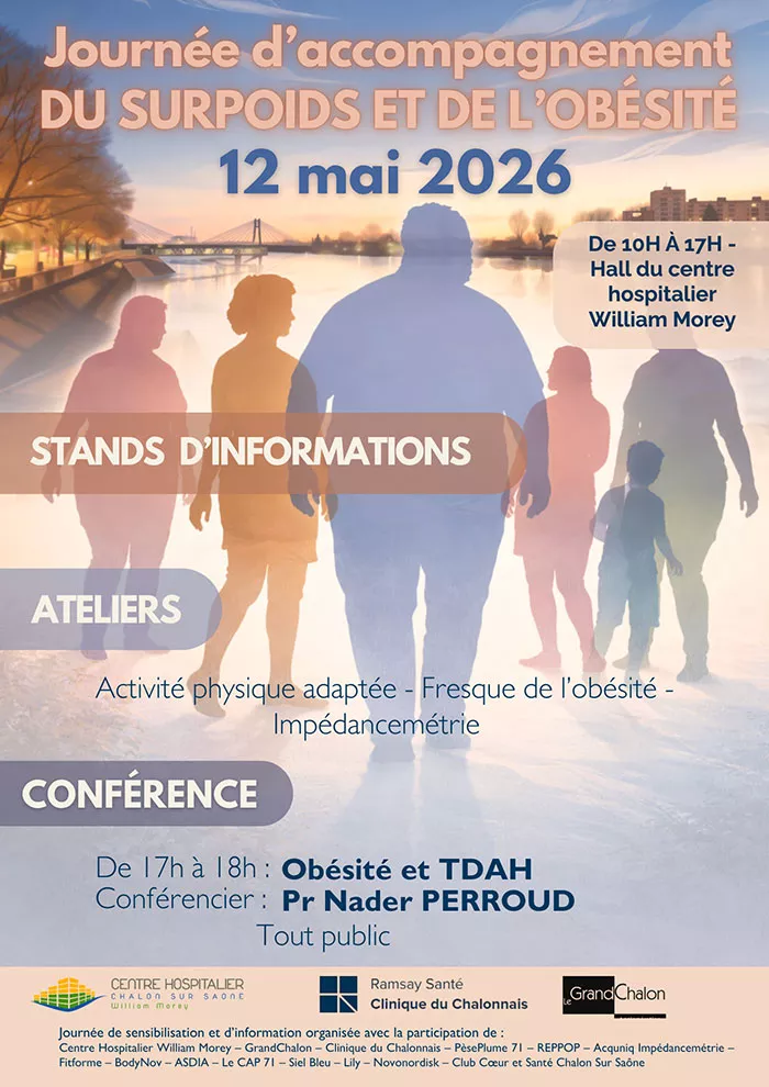 hop-chalon-220426