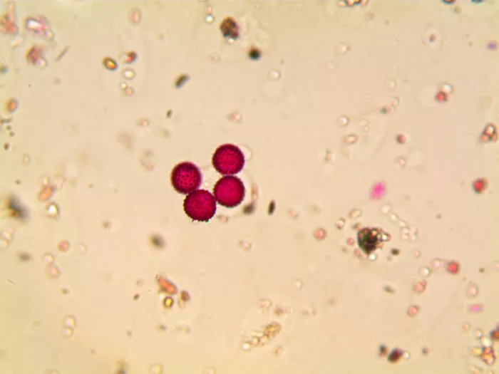 Grains d'ambroisie au mircoscope
